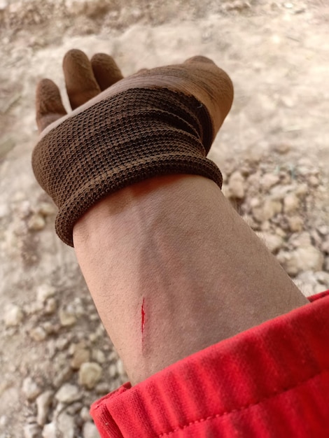 A close-up shot of a traveler's hands skillfully applying a bandage to another person's arm. Both are in a bustling market in Southeast Asia, showing the applicability of Emergency Travel First Aid Certification: Essential Skills for Confident Journeys - Limited Seats Available in everyday travel situations.